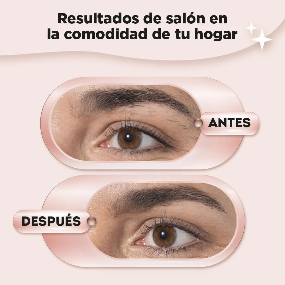 Antes de FLAWLESS