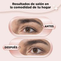 antes