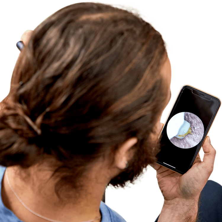 Smart Ear Cleaner NE3™ | 👂Limpiador de Oídos con Cámara