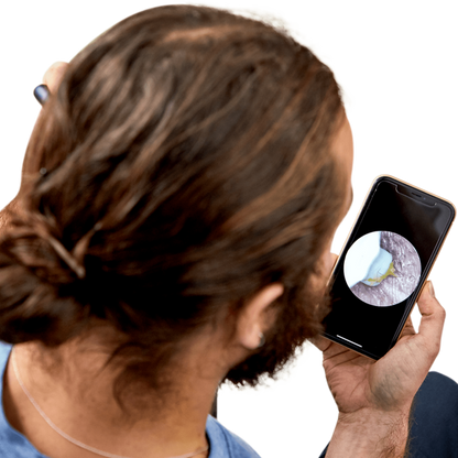 Smart Ear Cleaner NE3™ | 👂Limpiador de Oídos con Cámara